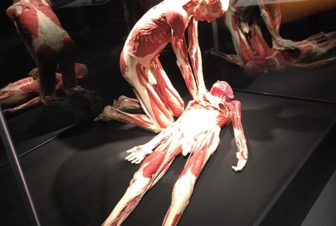 Ausstellung "Körperwelten"